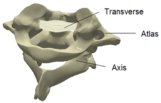 3D model of a neck ligament injury after whiplash